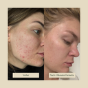 Vanilla | The Superior Collagen | Formetta