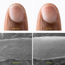 Bond Repair Treatment
